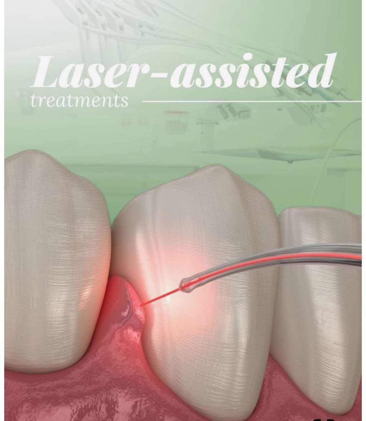 Laser Surgery