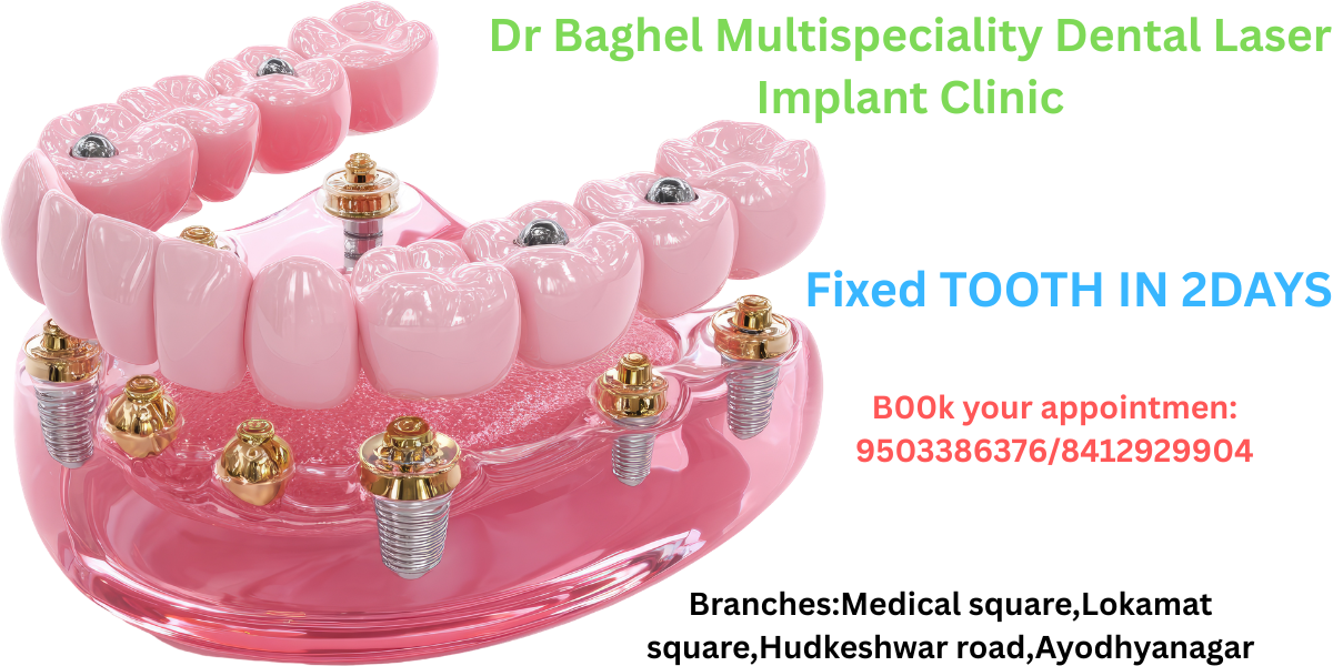 fixed tooth in 2 days website image