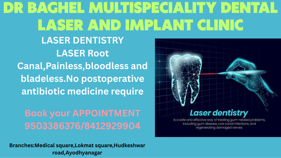laser root canal